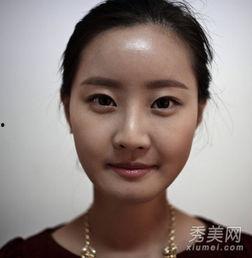 网红王珏整容,网红蜕变之路